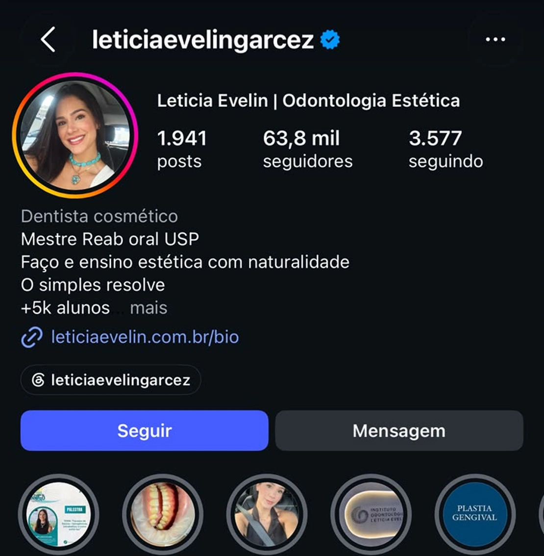 Perfil IG 04